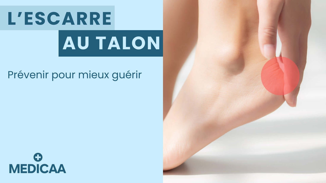 Escarre au talon : prévenir, soulager la pression et choisir un coussin adapté